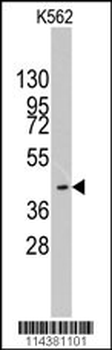 HMOF/MYST1 Antibody (C-term)