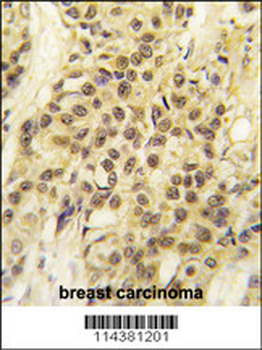 HMOF/MYST1 Antibody (C-term)