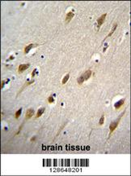 HARB1 Antibody (N-term)