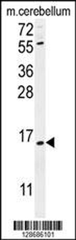 ANR39 Antibody (C-term)