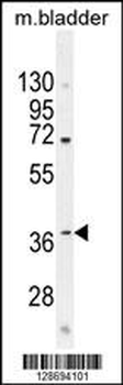 CL029 Antibody (N-term)