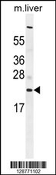 C1QL3 Antibody (N-term)