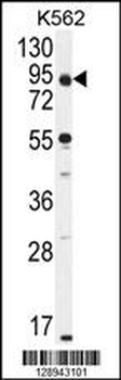KLRAQ1 Antibody (Center)