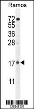 TTC9C Antibody (N-term)