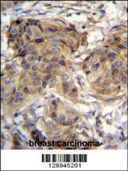 TTC9C Antibody (N-term)