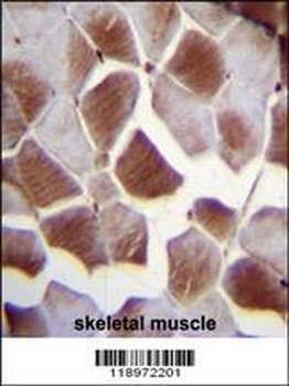 EIF2B4 Antibody (Center K161)