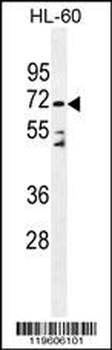 DPP3 Antibody (C-term)