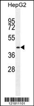 PRRT1 Antibody (Center)
