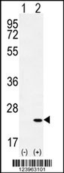 CRH Antibody (C-term)