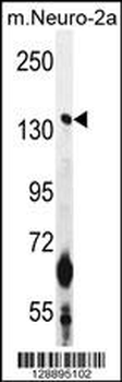 CAMSAP1 Antibody (N-term)