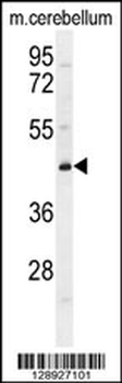 CYB5D2 Antibody (C-term)