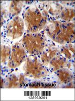 FAM108C1 Antibody (Center)