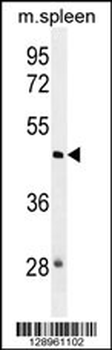 NSUN3 Antibody (N-term)