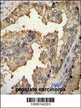 PRMT4 Antibody(Center)