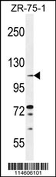 TLL2 Antibody (Center)