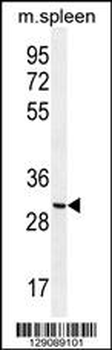 CCDC84 Antibody (N-term)