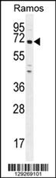 PNLDC1 Antibody (C-term)