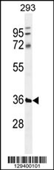 TMCO5B Antibody (C-term)