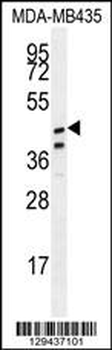 SAMD7 Antibody (Center)