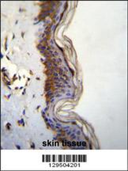 FHAD1 Antibody (C-term)