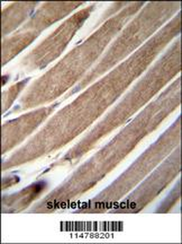 ATG4D Antibody (N-term)