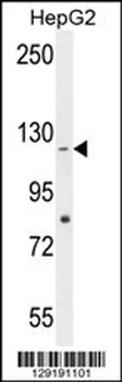 CCDC15 Antibody (C-term)