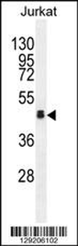 OR4N4 Antibody (N-term)