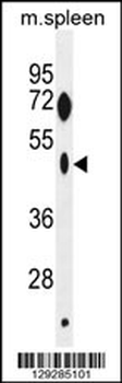 ZNF385C Antibody (N-term)