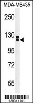 TTLL13 Antibody (Center)