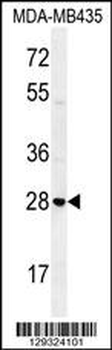STX19 Antibody (C-term)