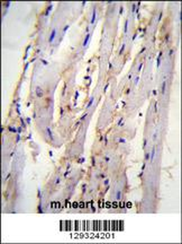 STX19 Antibody (C-term)