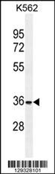 FOXI3 Antibody (Center)