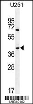 PRR16 Antibody (C-term)