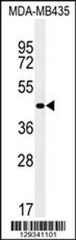 ZNF625 Antibody (N-term)