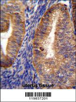 RUTBC1 Antibody (C-term)