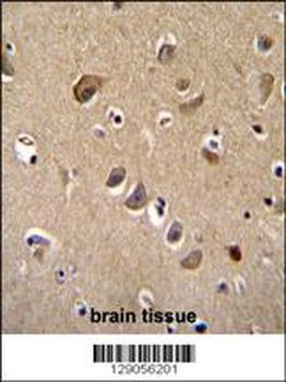 TTC9B Antibody (C-term)