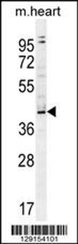 ZBTB42 Antibody (N-term)