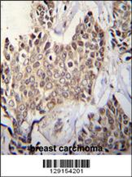 ZBTB42 Antibody (N-term)