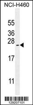 ARL17P1 Antibody (Center)