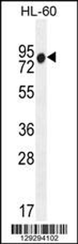 ZNF665 Antibody (N-term)