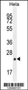 CPSF4L Antibody (C-term)