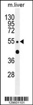 ZNF672 Antibody (C-term)