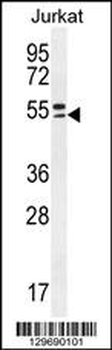 TRIM59 Antibody (N-term)