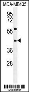 EPHX3 Antibody (C-term)