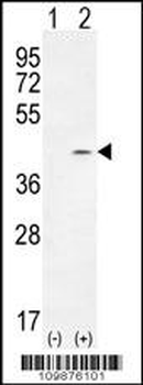 PTK9L Antibody (N-term)