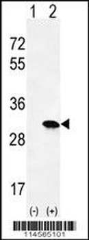 HRAS Antibody (C-term)