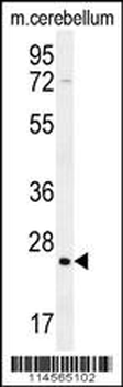 HRAS Antibody (C-term)