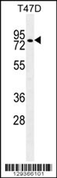 ZNF69 Antibody (C-term)