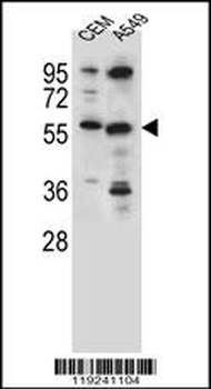 CSAD Antibody (Center)