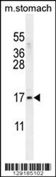 ZNF428 Antibody (N-term)